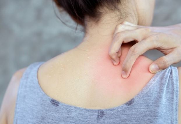 3 vị trí ngứa ngáy là dấu hiệu đường huyết tăng cao, bệnh tiểu đường đến rất gần: Chớ chủ quan