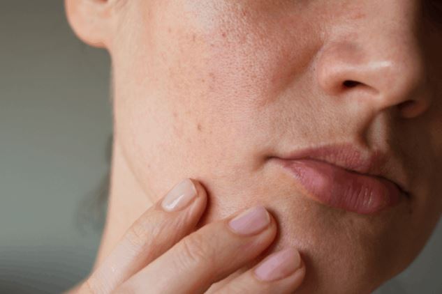 4 loại mặt nạ cải thiện tình trạng da bị khô sần, thô ráp