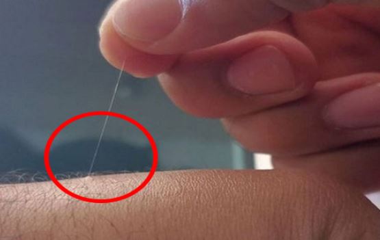 Tổ Tiên chỉ dạy: 3 vị trí lông mọc nhiều thì phát tài phát lộc, đừng dại mà tẩy đi