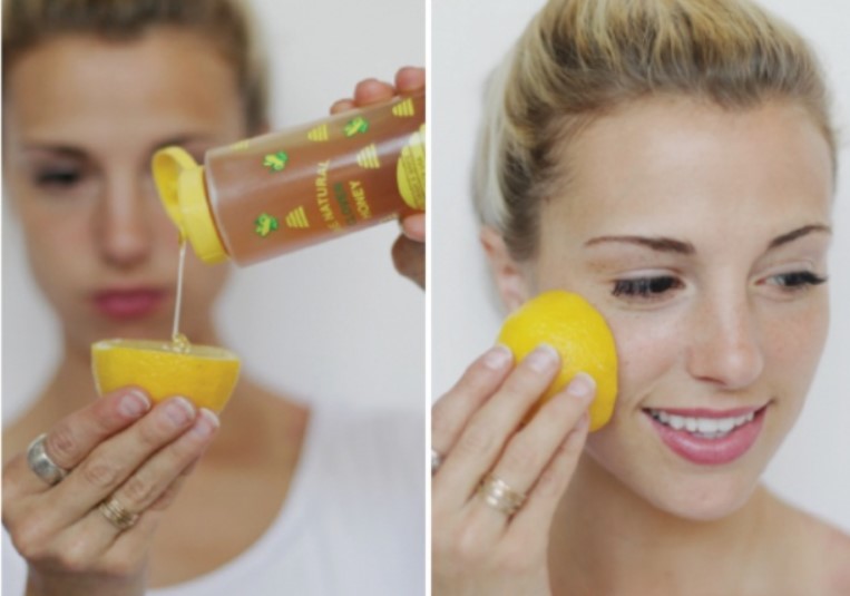 8 mẹo tự nhiên loại bỏ mụn đầu đen và mụn đầu trắng nhanh, hiệu quả