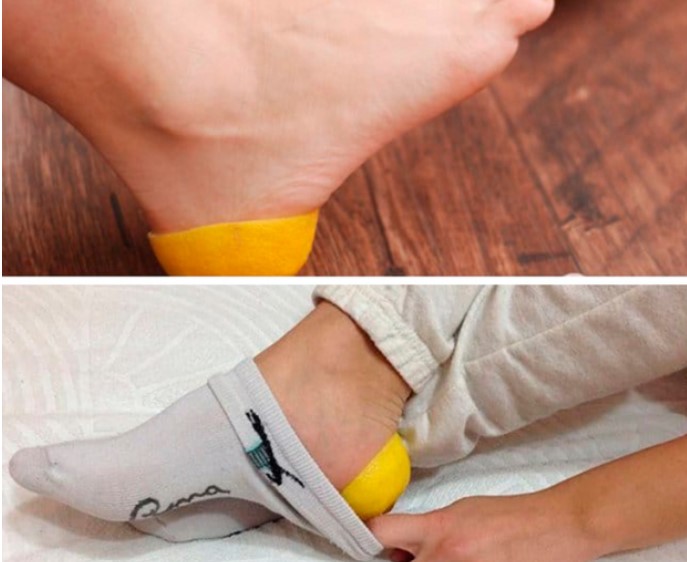 7 mẹo làm đẹp đơn giản: Khoai tây trị rạn da, kem đánh răng giúp môi hồng căng mọng