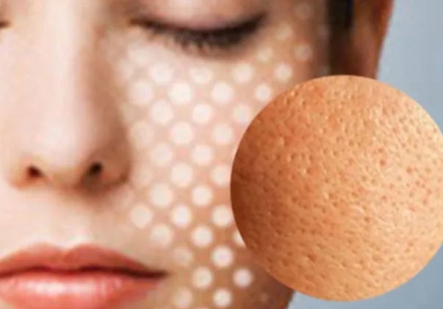 5 tuyệt chiêu se khít thu nhỏ lỗ chân lông không cần mỹ phẩm mà chỉ mất vài phút