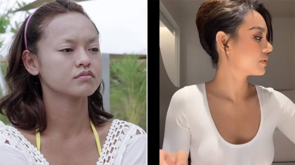 Nội dung chú thích ảnh