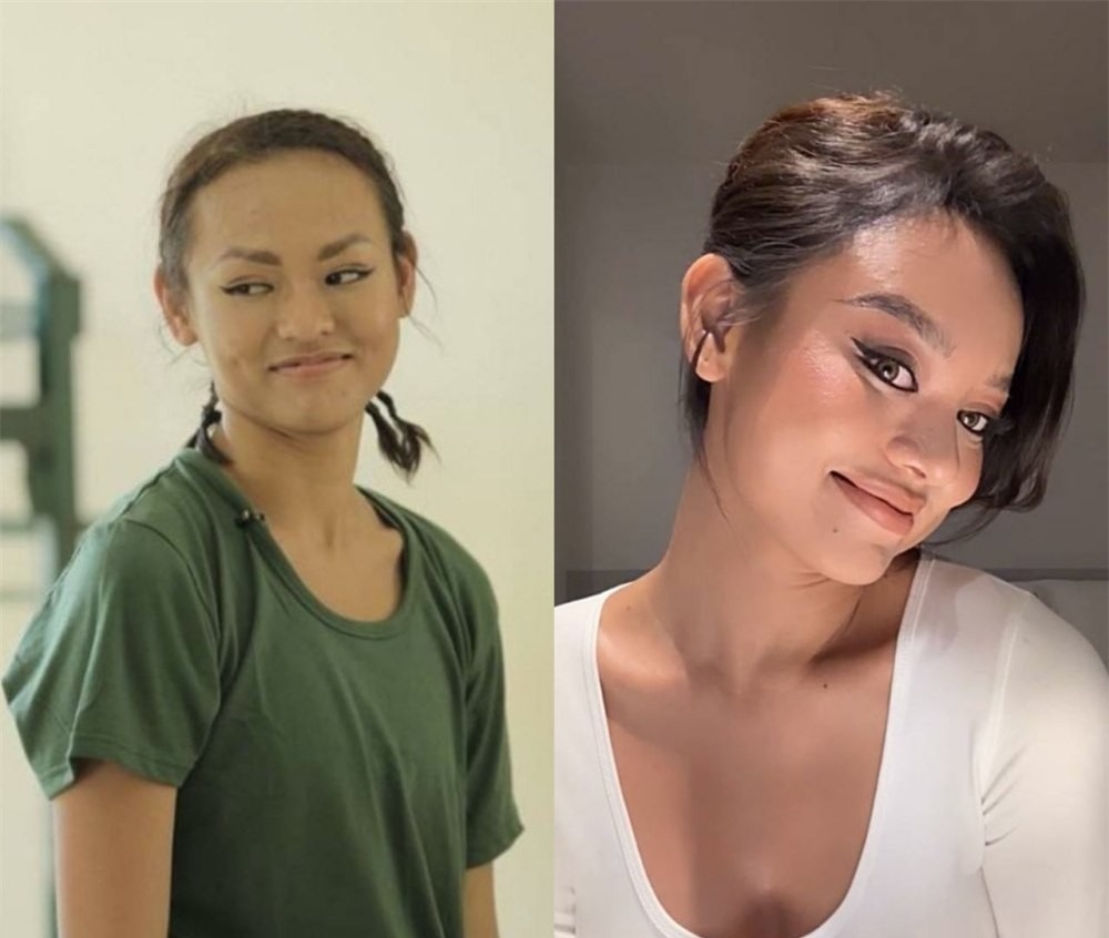 Nội dung chú thích ảnh