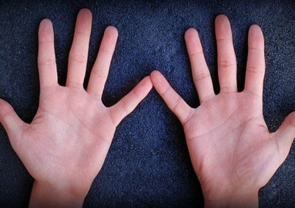 Người phúc mỏng, vận bạc thường có 5 điểm này trong lòng bàn tay, có 1 thôi cũng chật vật suốt đời