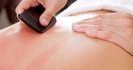 Cạo gió - cách chữa bệnh cổ xưa: 4 lưu ý không phải ai cũng biết