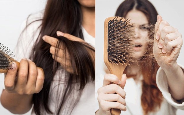 Những loại thực phẩm này có thể giúp bạn ngăn ngừa rụng tóc cực hiệu quả