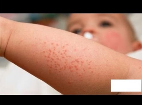 Con chảy máu đường tiêu hóa vì những sai lầm sau của cha mẹ