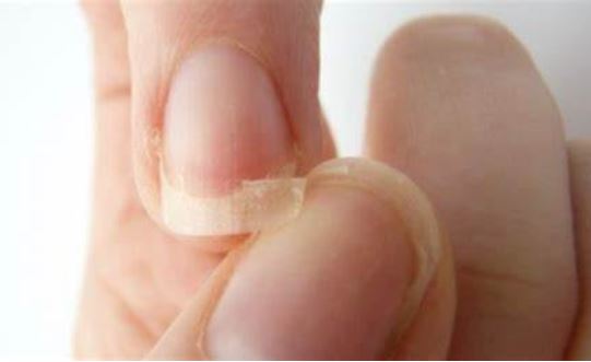 Những dấu hiệu cơ thể bạn đang thiếu hụt canxi trầm trọng