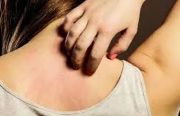 Ngứa liên tục ‘3 chỗ’ trên cơ thể, đừng nghĩ là dị ứng, có thể lượng đường trong máu quá cao