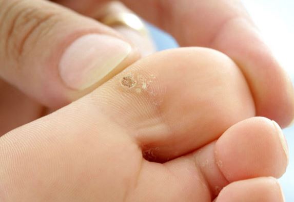 “Bỏ túi” nhanh những mẹo hay từ vỏ chuối