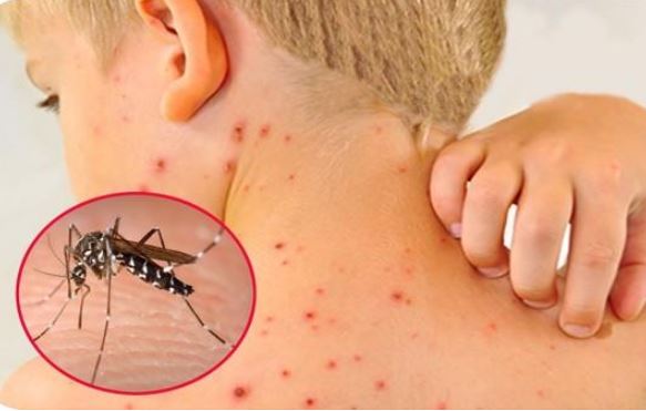 6 bệnh giao mùa thường gặp ở trẻ nhỏ, cha mẹ lưu ý để giúp con phòng tránh