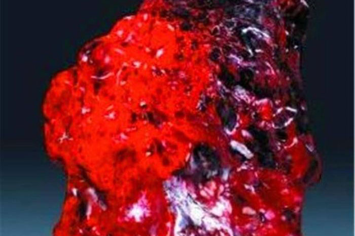 Bỏ ra 11 tỷ mua viên đá, cô gái sốc nặng khi biết giá trị thực của món đồ 