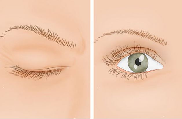 Liên tục nháy giật mắt có thể là lời cảnh báo sớm của 4 vấn đề bệnh tật