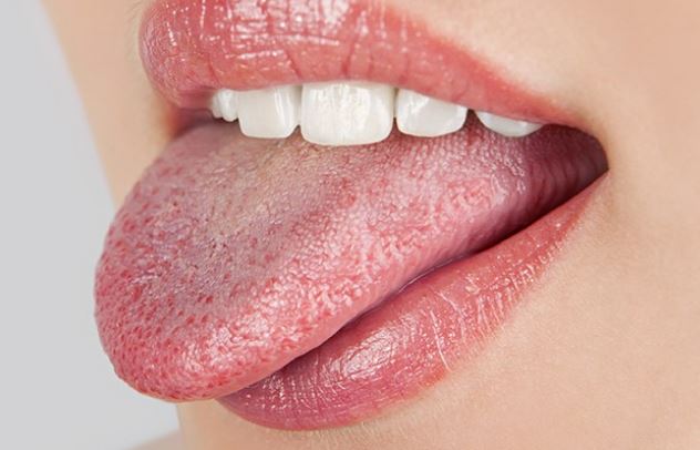 &#x110;o&#xE1;n b&#x1EC7;nh d&#x1EF1;a v&#xE0;o m&#xE0;u s&#x1EAF;c l&#x1B0;&#x1EE1;i, ai c&#xF3; d&#x1EA5;u hi&#x1EC7;u n&#xE0;y &#x111;i kh&#xE1;m ngay