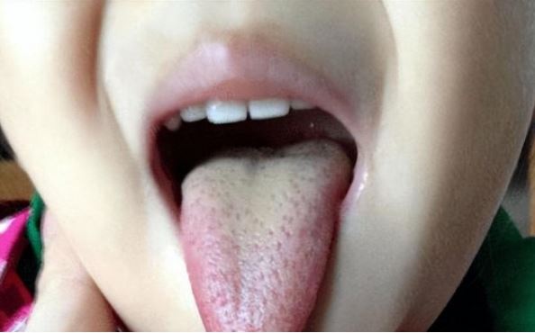 4 bộ phận trên cơ thể có màu vàng chứng tỏ dễ đoản thọ, ai cũng cần biết