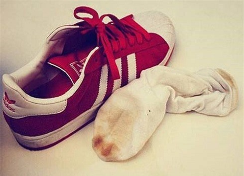 Cách đánh bay mùi hôi chân khi đi giày vào mùa hè ảnh 2