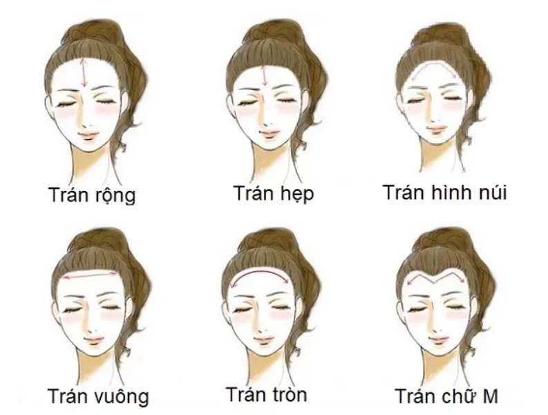 Các loại trán. Ảnh minh hoạ.