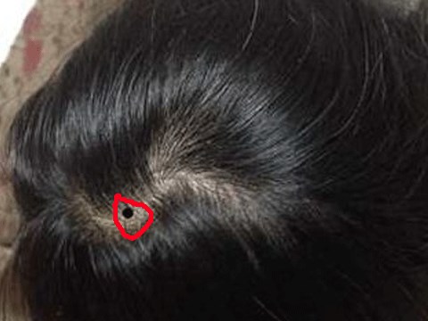 Những nốt ruồi đại phú, đại quý trên cơ thể chị em tuyệt đối đừng tẩy xóa