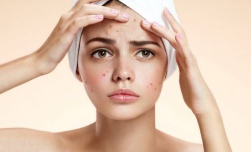 Trị mụn nhọt dễ dàng bằng cây lá trong vườn nhà