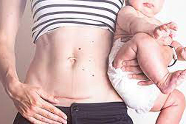 Làm điều này 2 lần/ngày giúp mẹ sau sinh giảm đau, nhanh lành vết thương