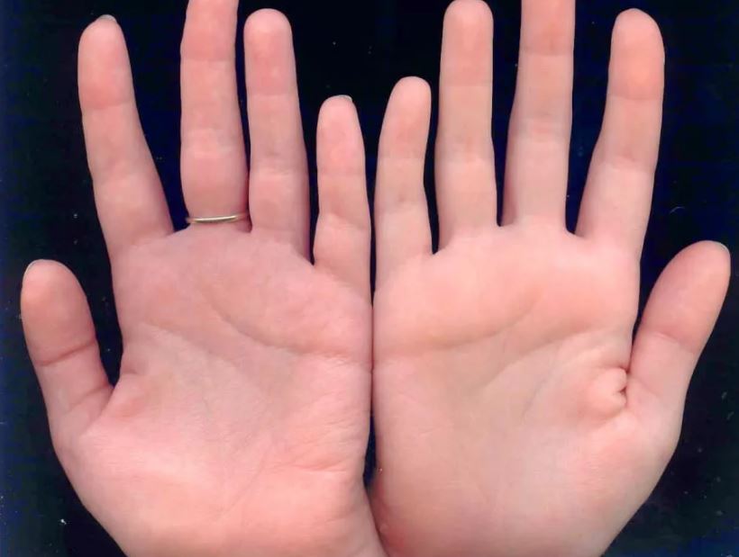 Người càng sống càng bạc phúc thường có 3 đặc điểm này trên lòng bàn tay, càng già càng cô đơn, nghèo khổ