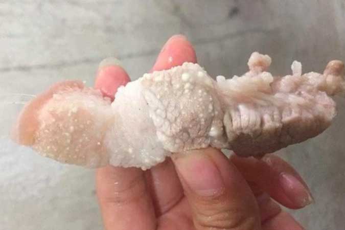 Những loại thực phẩm dễ nhiễm giun sán và cách nhận biết, phòng tránh