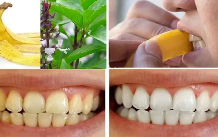 Cách làm trắng răng tại nhà bằng nguyên liệu vứt đi trong bếp cực ngạc nhiên