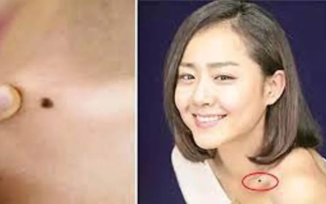 7 nốt ruồi quý hơn vàng, dù là nam hay nữ đều phát tài hơn người, càng già càng giàu có