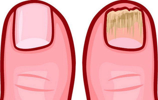 Cơ thể bạn đang chất chứa đầy độc tố nếu gặp phải hàng loạt triệu chứng bất thường sau