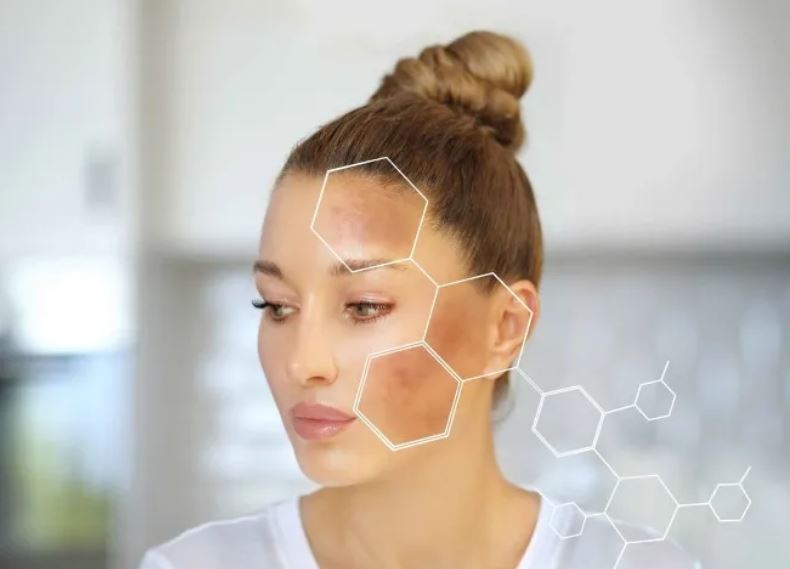 4 cách giảm nám, tàn nhang, giúp da đều màu