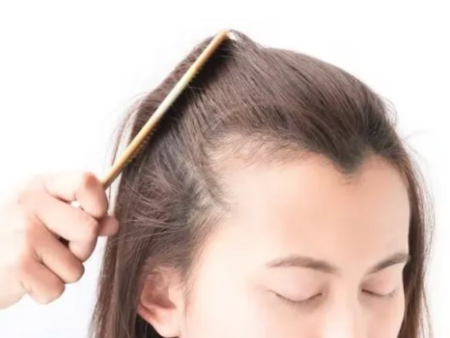 5 thói quen khiến tóc dưỡng mãi vẫn rụng lả tả