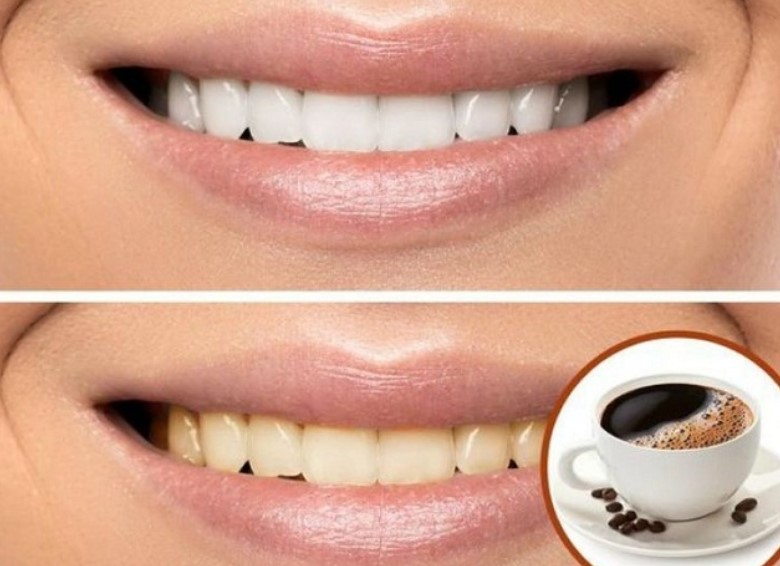 Làm cách nào để uống nhiều cà phê mà răng vẫn trắng sáng