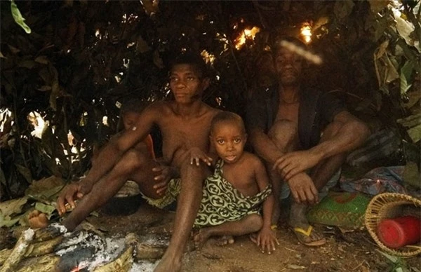 Những đứa trẻ thuộc bộ lạc Baka thường hay mắc các bệnh về đường tiêu hoá.