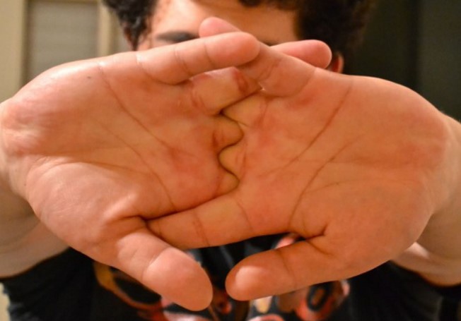 Thói quen bẻ khớp kêu răng rắc: Chuyên gia cảnh báo sướng tai nhưng hại thân