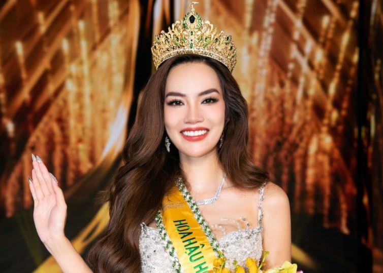 Ảnh hiếm thời còn niềng răng của Tân Hoa hậu Lê Hoàng Phương