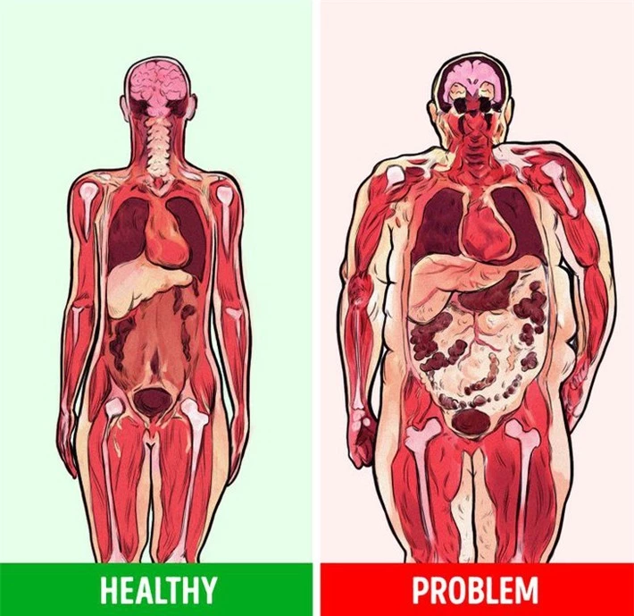 Bạn có nghĩ rằng mỡ bụng thực sự nguy hiểm cho sức khỏe của chúng ta hay không? - Ảnh 2.