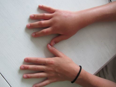 Những dấu hiệu ở tay, chân cảnh báo thận của bạn đang có vấn đề, hãy đi khám ngay trước khi quá muộn