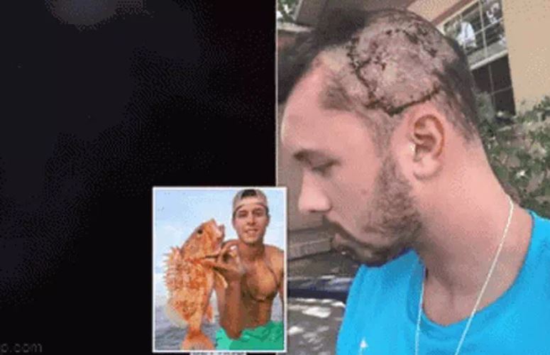 Đi săn răng cá mập rồi bị cá sấu ngoạm vào đầu, chàng trai thoát chết nhờ 2 thứ không ngờ