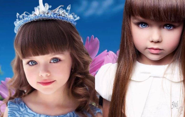 Bé gái từng gây sốt với khuôn mặt đẹp như búp bê bây giờ thế nào?