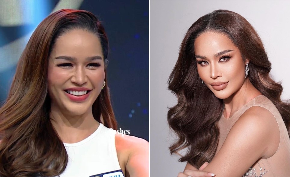 Á hậu Hoàn vũ Thái Lan bị chê xấu vì lạm dụng thẩm mỹ