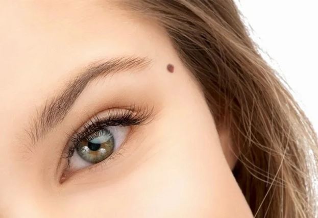 Điểm mặt những nốt ruồi ‘quý như vàng’, có thể giúp chủ nhân chiêu tài, hút lộc