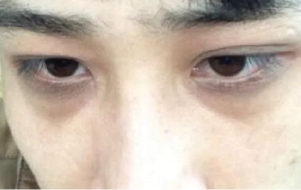 Đàn ông phận mỏng, phúc bạc thường có 4 nét này trên mặt, tài ba tới mấy cũng khó thoát nghèo