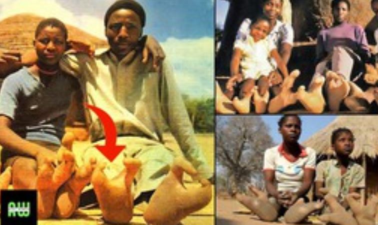 Bí ẩn về bộ tộc "đà điểu": Không thể đi giày vì thiếu ngón chân!