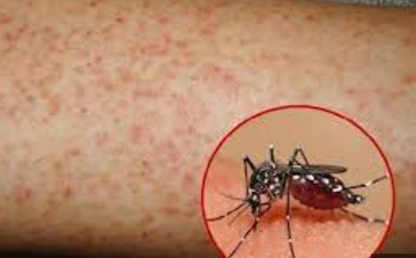 Sốt xuất huyết nguy hiểm đến mức nào?