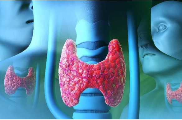 Không muốn u tuyến giáp phát triển nhất định đừng ăn nhiều 3 món này