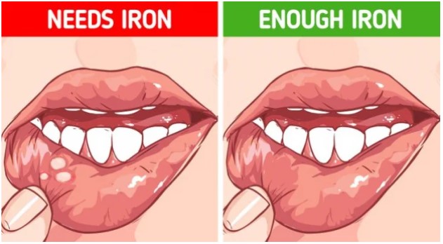 4 mẹo đơn giản giúp bạn phát hiện các vấn đề cơ thể đang gặp phải