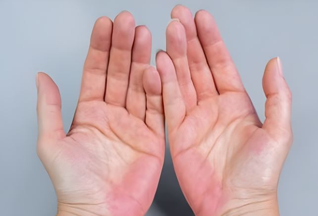 Lòng bàn tay có 5 dấu hiệu này, dù nam hay nữ sở hữu 2/5 cũng rất may mắn, hôn nhân viên mãn