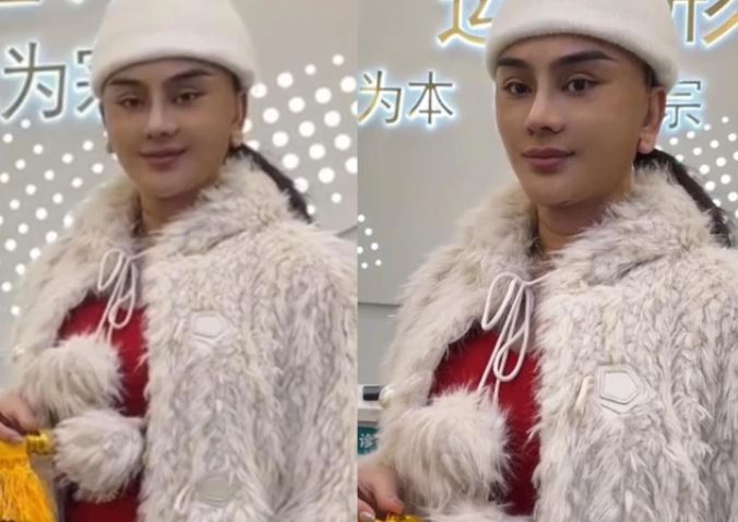 L&#xE2;m Kh&#xE1;nh Chi &#x27;photoshop&#x27; &#x1EA3;nh &#x111;i ph&#x1EAB;u thu&#x1EAD;t: Nhan s&#x1EAF;c th&#x1EAD;t kh&#xE1;c xa tr&#xEA;n m&#x1EA1;ng