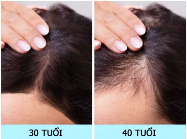 7 bộ phận bên ngoài cơ thể nói lên tuổi thật của bạn